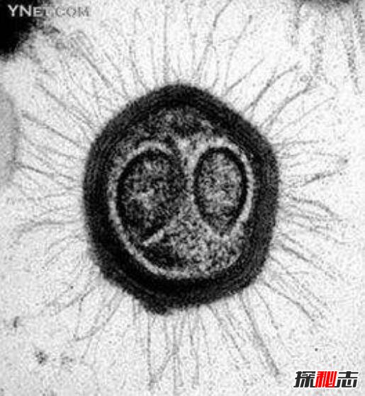 世界上最大的病毒，米米病毒直径800纳米(酷似细菌)