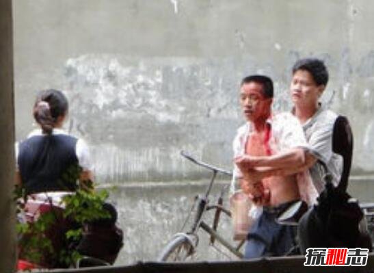 广西柳州飙血哥事件，头破血流还手持木棍要血拼到底