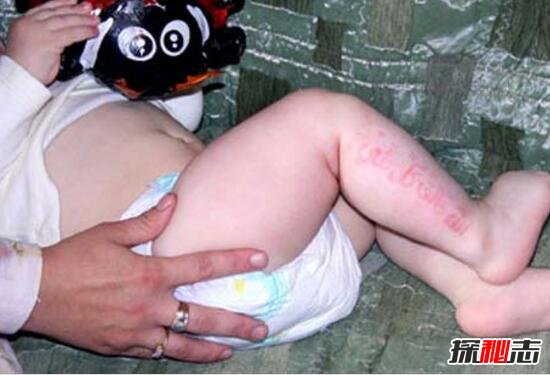 俄罗斯婴儿腿上皮肤能显示古兰经经文，胎记惊现经文/真主显灵