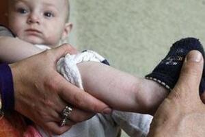 俄罗斯婴儿腿上皮肤能显示古兰经经文，胎记惊现经文/真主显灵