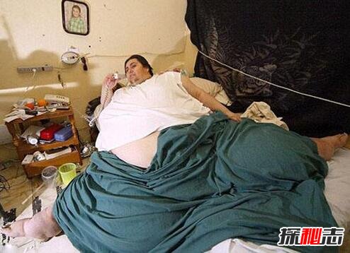 世界最胖曼努埃尔·乌里韦，1200斤成功减肥400斤后仍胖死