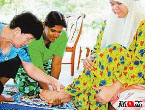 马来西亚女子脚吐彩色晶石，脚趾能吐彩色晶石(罕见怪病)