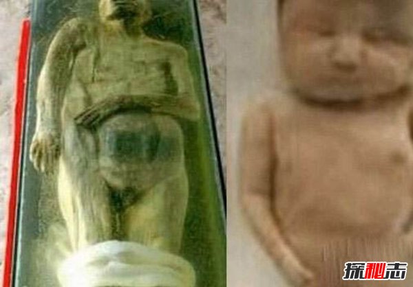 千年女尸生下7斤重女婴 女婴会啼哭不幸只活过72小时