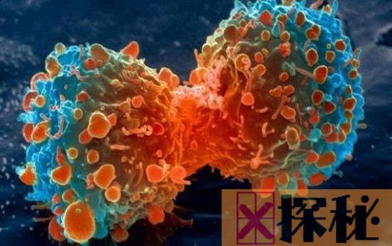 海拉细胞污染事件揭秘：注射癌细胞人体实验(骇人听闻)