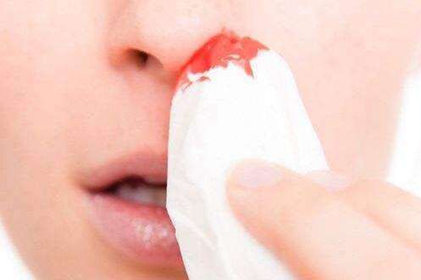 为什么鼻子总爱出血?鼻部或全身疾病所致(鼻腔血管破裂)