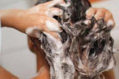 长期不洗头有什么危害 不仅不卫生而且影响发质