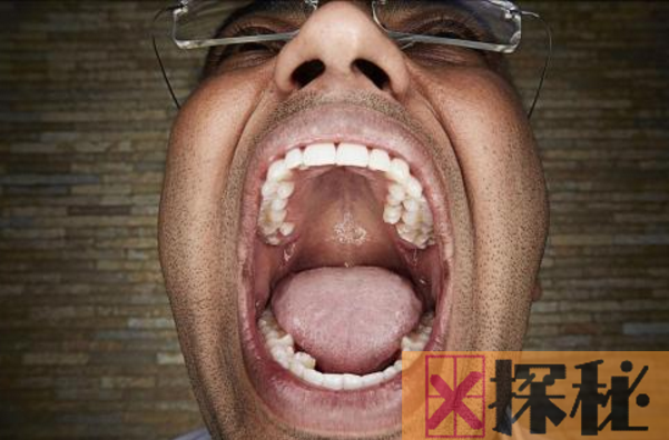 世界上牙齿最长的人，长17CM的巨牙是假新闻(最长3.67cm)