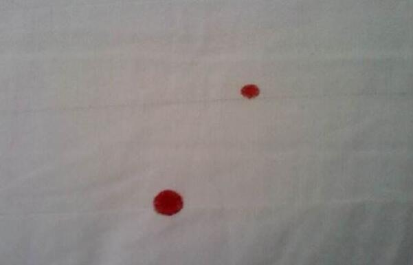 血弄床单上怎么办，用湿巾擦/凉水搓洗（用草酸清洗）