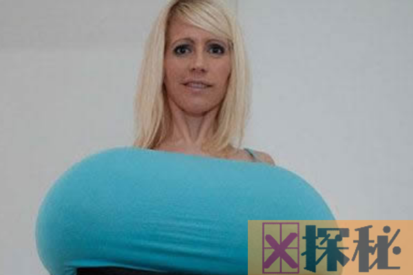 世界上最大的乳房:胸围154厘米(每个乳房重9公斤)