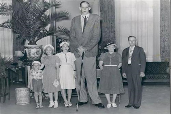 历史上世界上最高的人是谁 身高两米七二已经去世