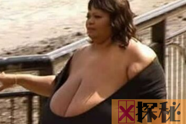 世界上乳房下垂最严重的女人:掉到腰部(像泄气的皮球)