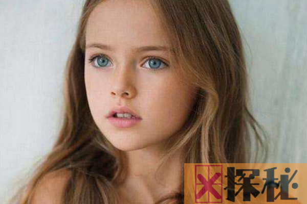世界上最美的女孩:拥有罕见蓝色瞳孔(俘获2百万粉丝)