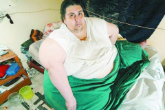 世界上最胖的男人:重达1194斤(连续9年未下床)