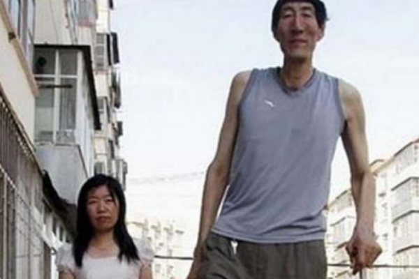 世界上最长的手臂:全长可达1.06米(是普通人的一倍)