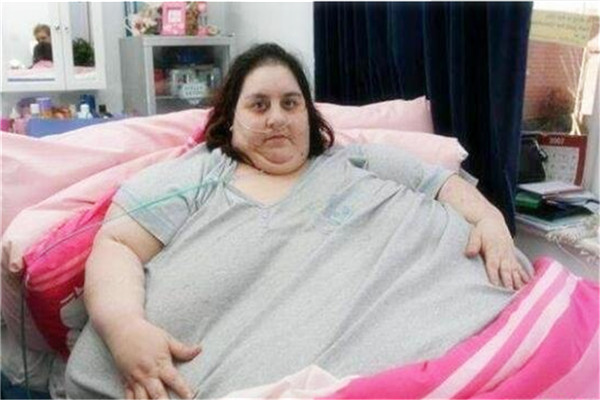 世界最胖的女人排行榜 卡罗尔耶格尔突破1500斤