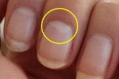 指甲半月痕代表什么：健康圈(显示人体健康状况)