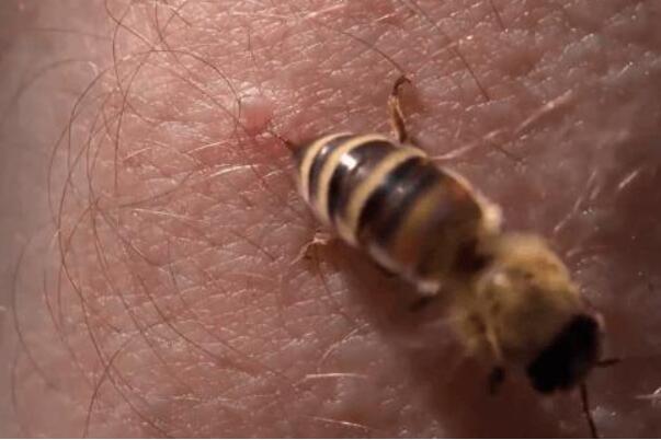 为什么蜜蜂蛰人后会死：丧失重要内脏(2到3小时死亡)