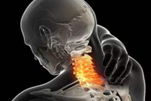 颈椎病有哪些症状：颈背疼痛、僵硬(一种常见的疾病)
