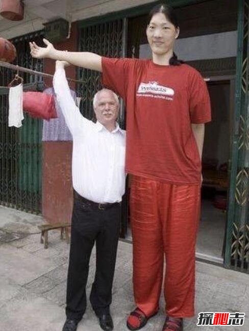 世界第一女巨人姚德芬，身高2.4米患垂体瘤疯长(已去世)
