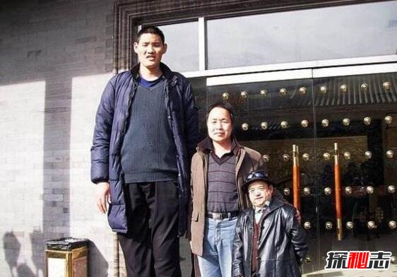 中国第一巨人赵亮，自然生长身高2.46米(没患巨人症)