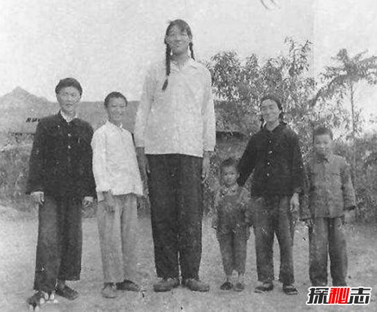 世界上最高的女性，曾金莲(身高2.48米/只活了18岁)
