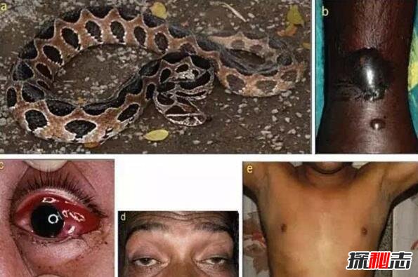 亚洲最致命毒蛇圆斑蝰，被咬不死也肾衰竭(俗称肾亏蛇)