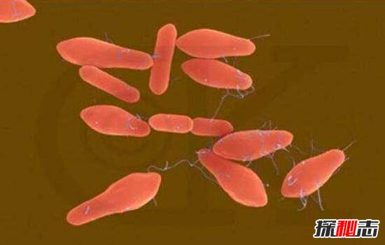 盘点十大世界上最毒的物质，H型肉毒杆菌(一克毒死一亿人)