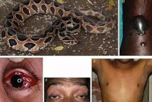 亚洲最致命毒蛇圆斑蝰，被咬不死也肾衰竭(俗称肾亏蛇)