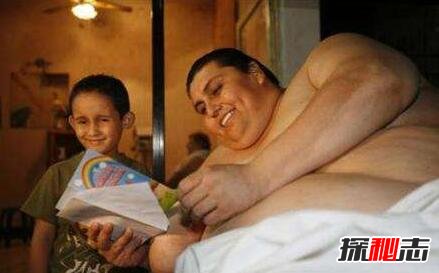 世界最胖曼努埃尔·乌里韦，1200斤成功减肥400斤后仍胖死