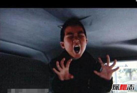 科学揭秘重庆开县的僵尸男孩，手足僵硬吸食人血(患癔症)