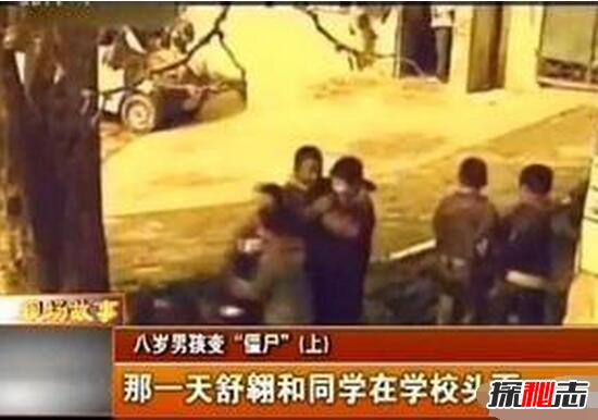 科学揭秘重庆开县的僵尸男孩，手足僵硬吸食人血(患癔症)
