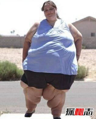 世界最胖女人苏珊娜·埃曼，1400斤还想挑战极限变更胖