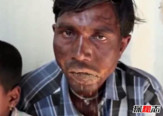 印度不吃饭的奇人，8年未进食任何食物(靠阳光维持生命)
