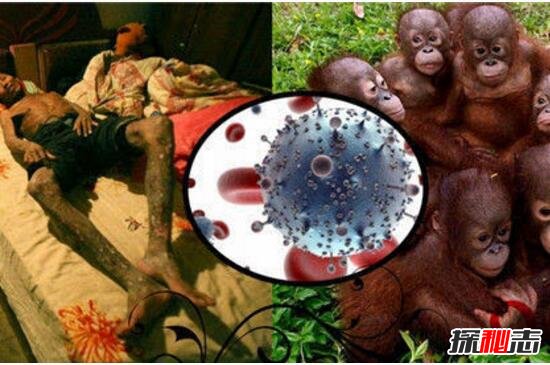 艾滋病的起源与发展解析，起源野生动物黑猩猩(源于非洲)