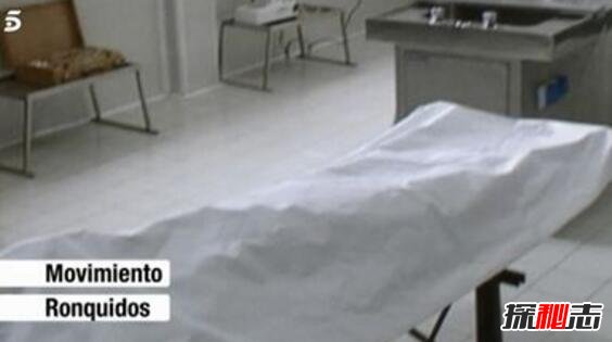 西班牙囚犯确认死亡复活，实则患癫痫吃错药导致呼吸暂停