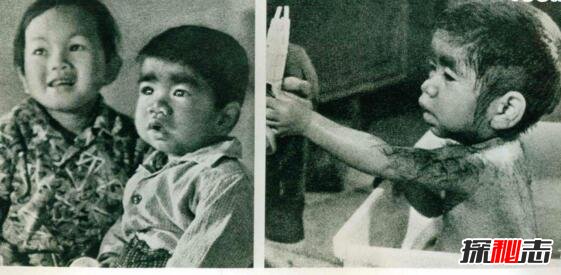 中国第一毛孩图片，毛孩于震寰全身毛发依旧找到真爱