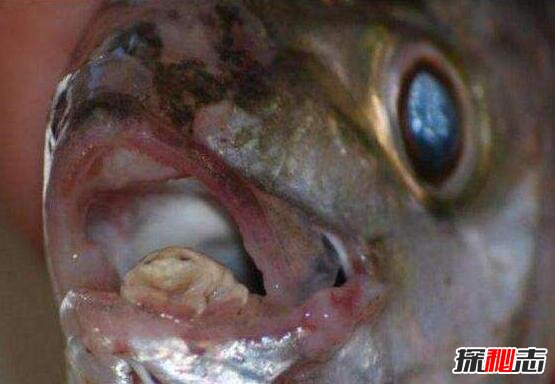 贝蒂寄生虫又叫外星寄生虫，寄生在鱼嘴可能你每天都在吃