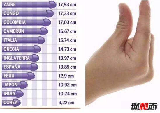 世界上阴茎最短小的男人，竟然只有1厘米(性器官发育不全)