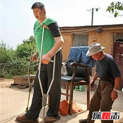 世界上最高的5个人：清朝巨人詹世钗3.19米,真实照片曝光