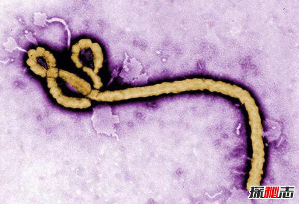 世界十大恐怖病毒 埃博拉可让活人融化惊悚至极