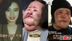 韩国电风扇阿姨韩慧景去世 整容前后对比照曝光