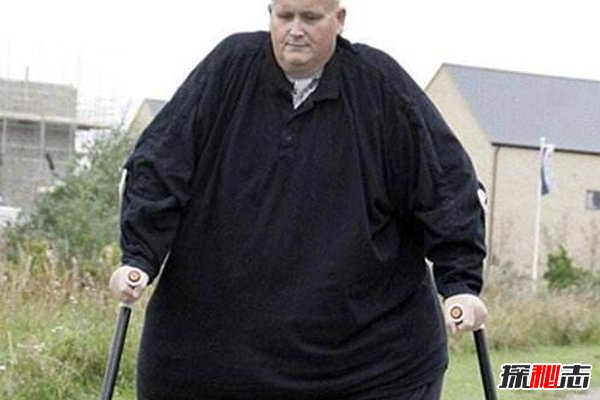保罗·马森:世界首胖成功减重292公斤(最胖445kg过半吨)