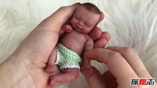 世界最小男婴平安出院：重量仅268克（巴掌大）