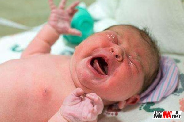 哪个国家死的婴儿最多?10个婴儿死亡率最高的国家