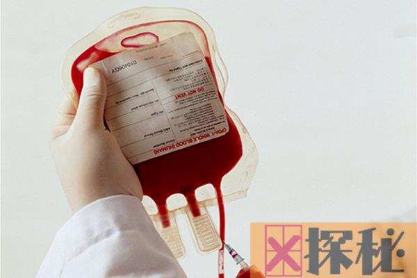 为什么血型不合就不能输血?会引发凝集反应(红细胞变皱)