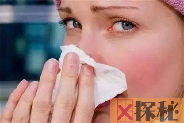 为什么鼻子总爱出血?鼻部或全身疾病所致(鼻腔血管破裂)