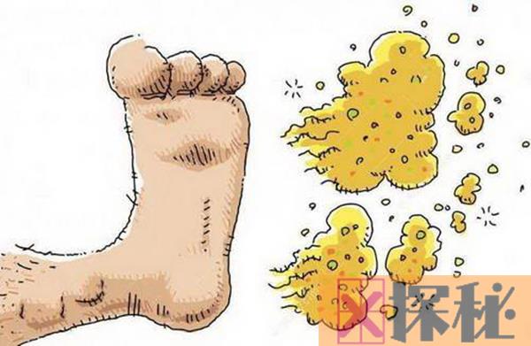 脚臭是什么原因引起的?怎样更好避免脚臭