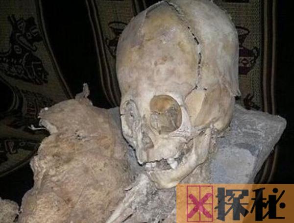 秘鲁考古惊现巨大头骨 科学家认为是外星人骨骼
