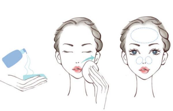 化妆水和爽肤水的区别，爽肤水是化妆水的一种（补充脸部水分）