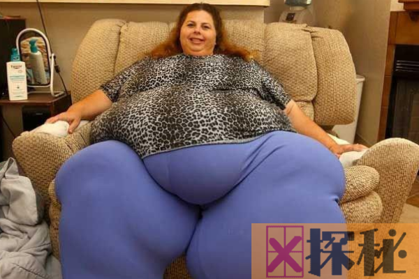 世界上最胖的人是谁?体重堪比一辆挂车(最重达1500斤)